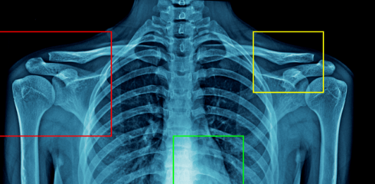 X-ray Film Object Localization