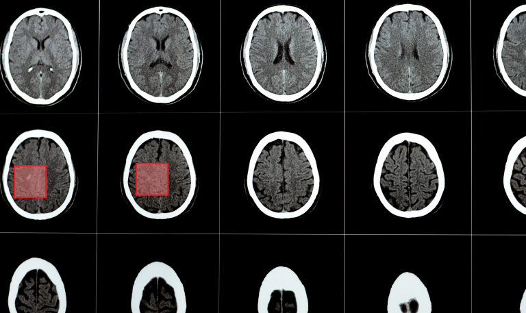 Computer Vision in Healthcare